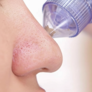 Pore Cleansing Device