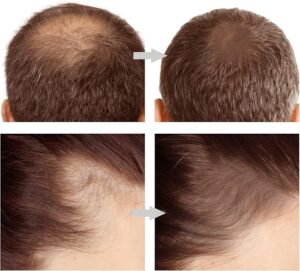 Hairline Powder Stick