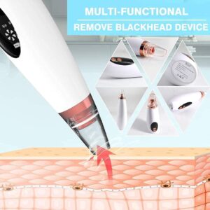 61Fb5BWhmCL._SL1000_ Multifunctional blackhead remover