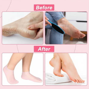 Silicone Gel Heel Socks
