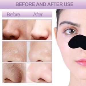 Charcoal Nose Strips