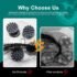 Smart Scalp Massager